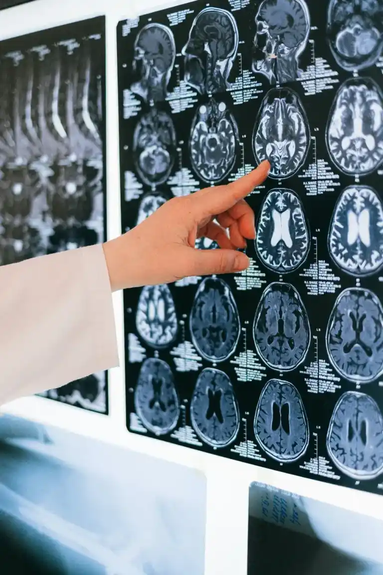 traumatic-brain-injury-768x1152-1.webp